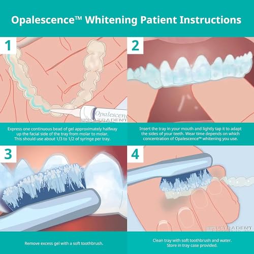 Opalescence 35% Gel Syringes Teeth Whitening - Refill Kit (4 Packs / 8 Count) Carbamide Peroxide. Made by Ultradent, in Cool Mint Flavor. Tooth Whitening Refill Syringes 5197-4