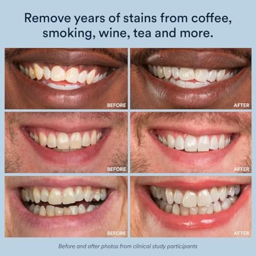 Auraglow Teeth Whitening Strips, Sensitive Whitening Strips, 14 Whitening Treatments, 8% Hydrogen Peroxide with Nano Hydroxyapatite (nHAp) to Reduce Sensitivity and Protect Enamel, 28 Strips, Mint