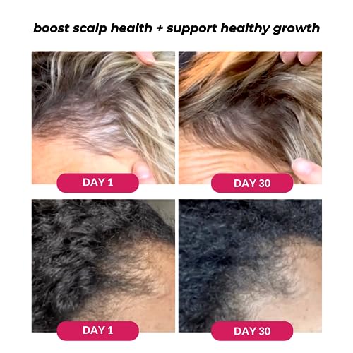 Love Ur Curls - Healthy Scalp Serum Growth Hair Activator, Turmeric & Basil Extracts for Deep Moisturizing and Thicker Full Hair, Vegan, 50mL