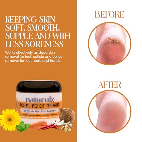 Naturulz Total Foot Repair 4oz – No Junk Foot Cream for Dry, Rough Skin & Cracked Heels, Lightweight & Compact Moisturizer for Feet, Knees, Elbows & Hands, Softens, Repairs & Smooths Cracked Skin